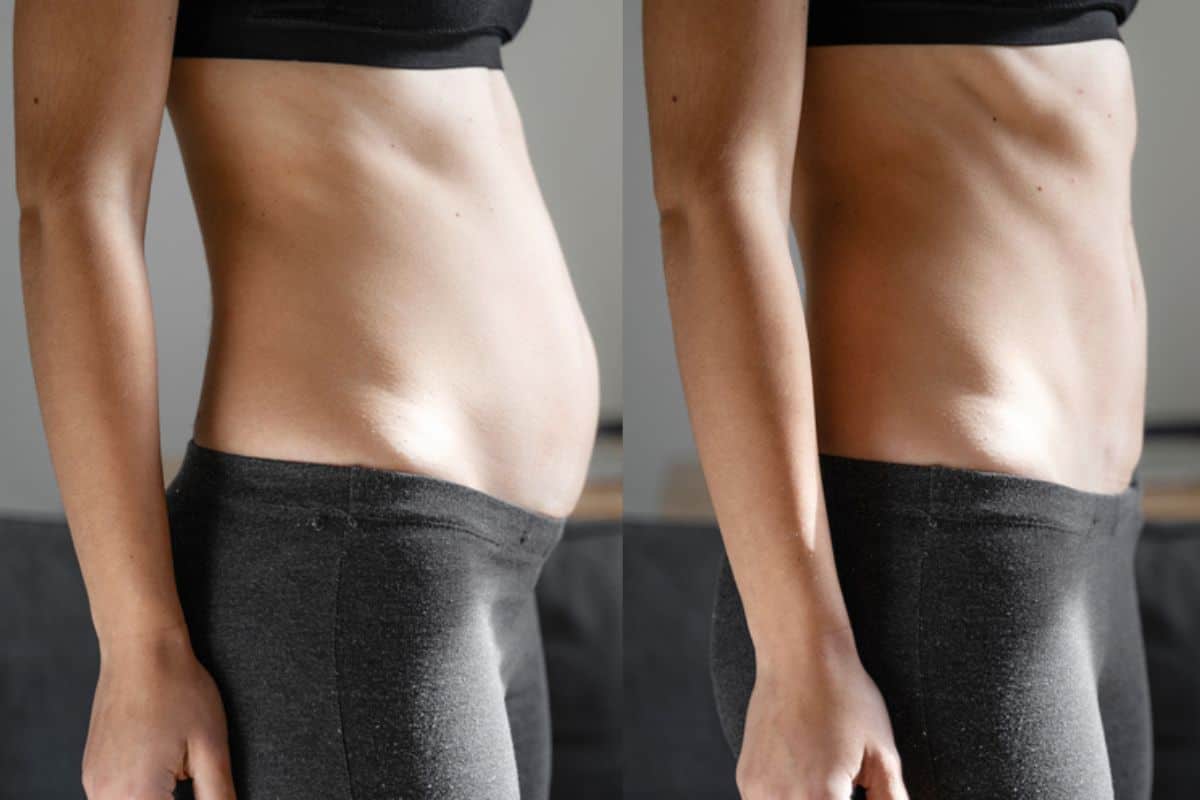 Post-Pregnancy: What Happens to Your Abdominal Muscles After Birth Milton Keynes