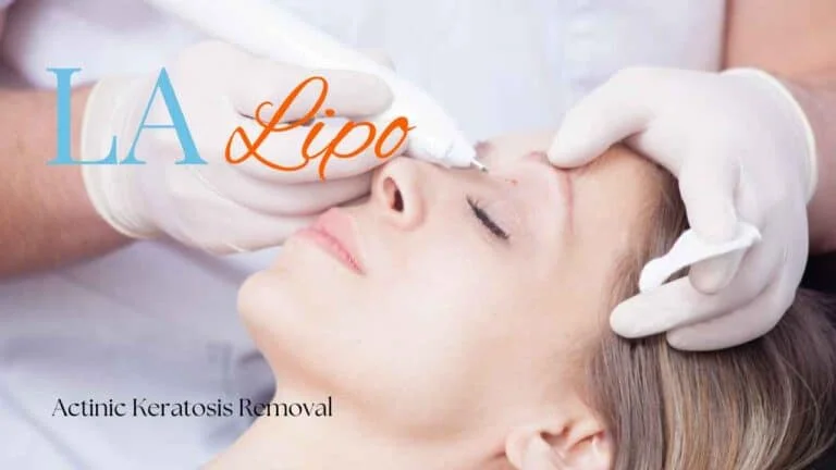 Woman receiving Actinic Keratosis Removal Treatment Milton Keynes