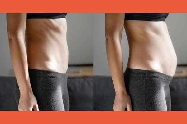 LA-EMS Body Sculpting results Milton Keynes