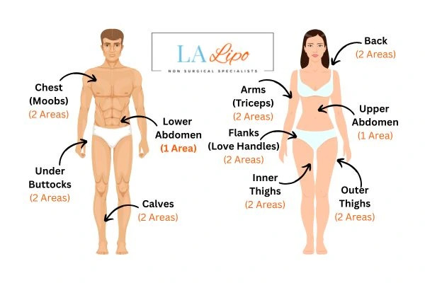 LA LIPO Cryolipolysis Areas Milton Keynes