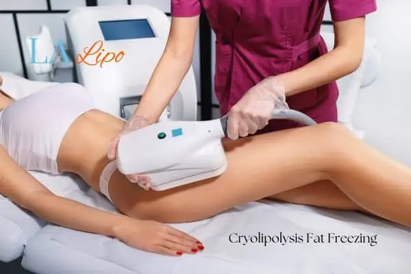Woman receiving coolsculpting Milton Keynes treatment on her thighs