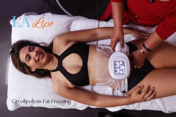 woman getting cryolipolysis Milton Keynes