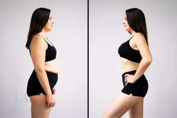 link between body image and mental health Milton Keynes