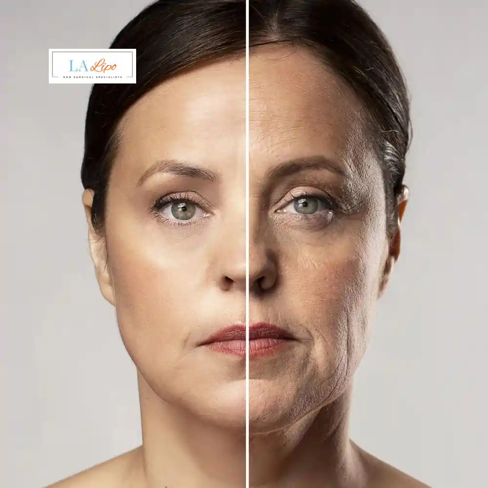 How Can You Tell If Non-Surgical Skin Tightening Is Right for You Milton Keynes?