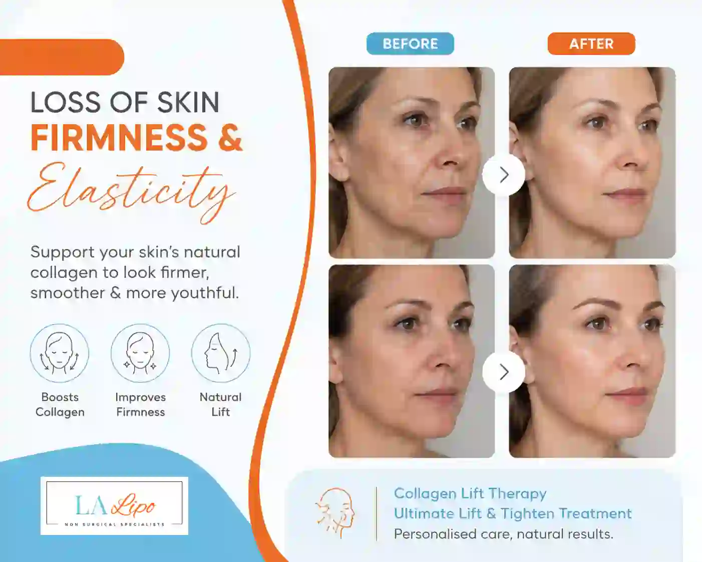 Sign #7: Loss of Skin Firmness and Elasticity Milton Keynes