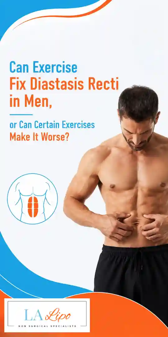 Can Exercise Fix Diastasis Recti in Men, or Can Certain Exercises Make It Worse Milton Keynes?